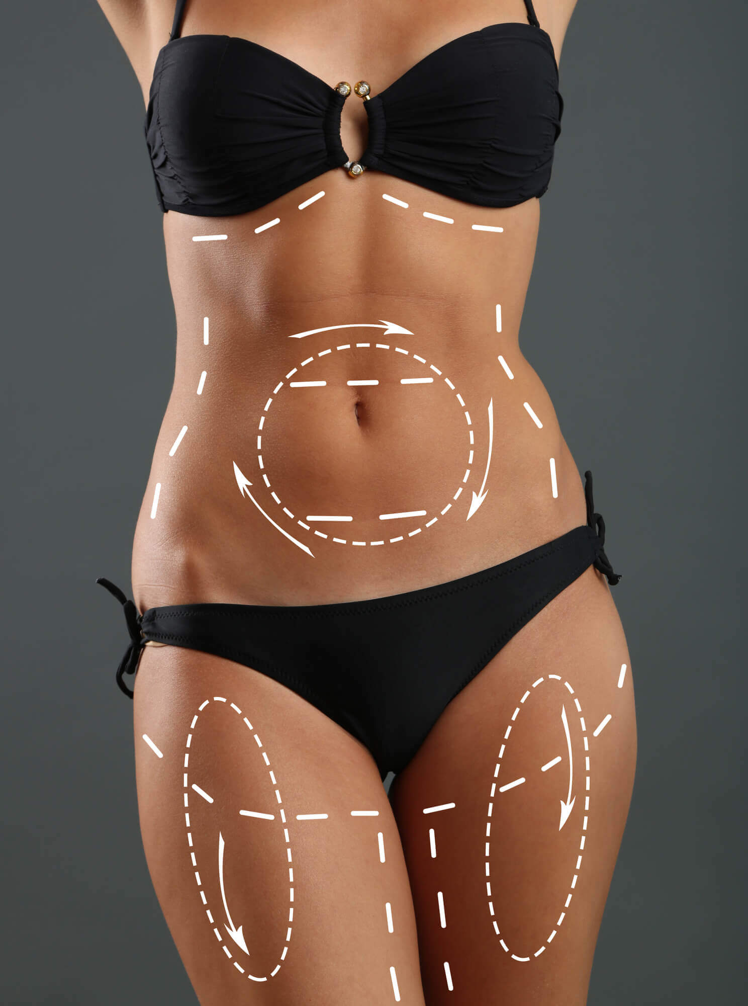 Body contouring <br><span class='mini'>(Modelácia tvaru tela)</span>